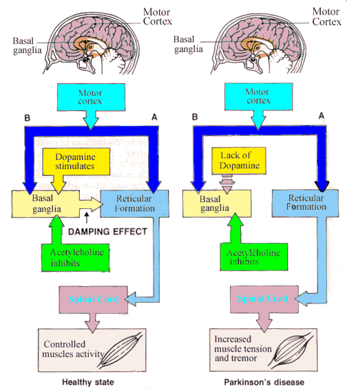 Parkinsona
              slimības mehānisms